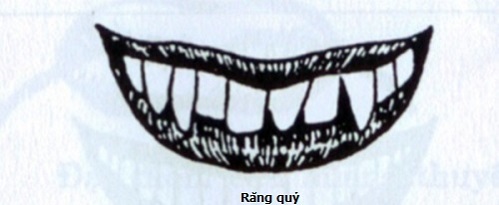 Răng quỷ là loại răng gì? Răng quỷ là loại răng gì?