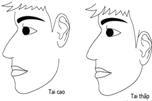 tướng tai cao hơn mắt ở nam nữ có gì đặc biệt?-1