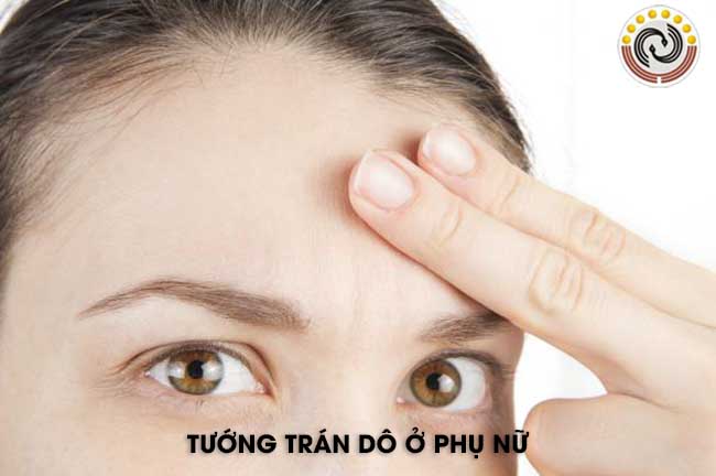 trán xệ ở phụ nữ
