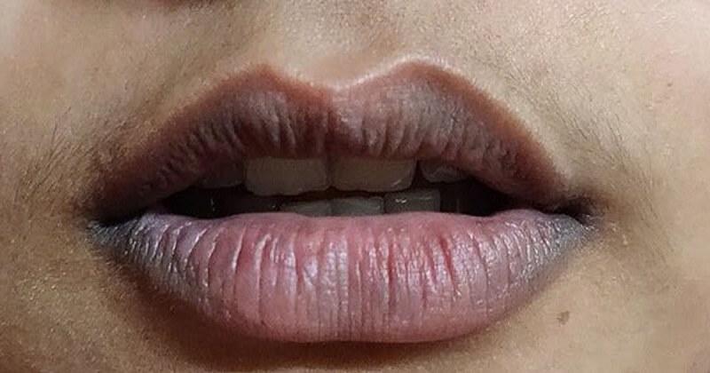 mat-trang-moi-tham mat-trang-moi-tham-2